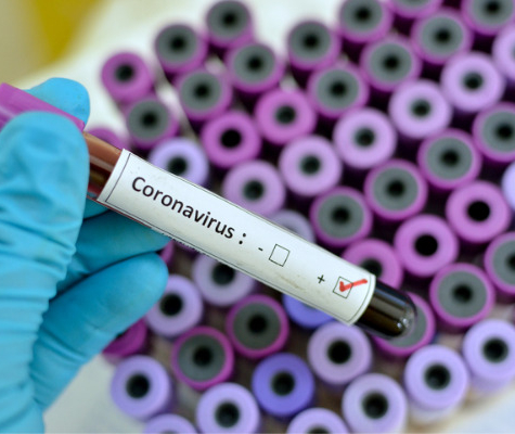 Image of positive coronavirus test in vile